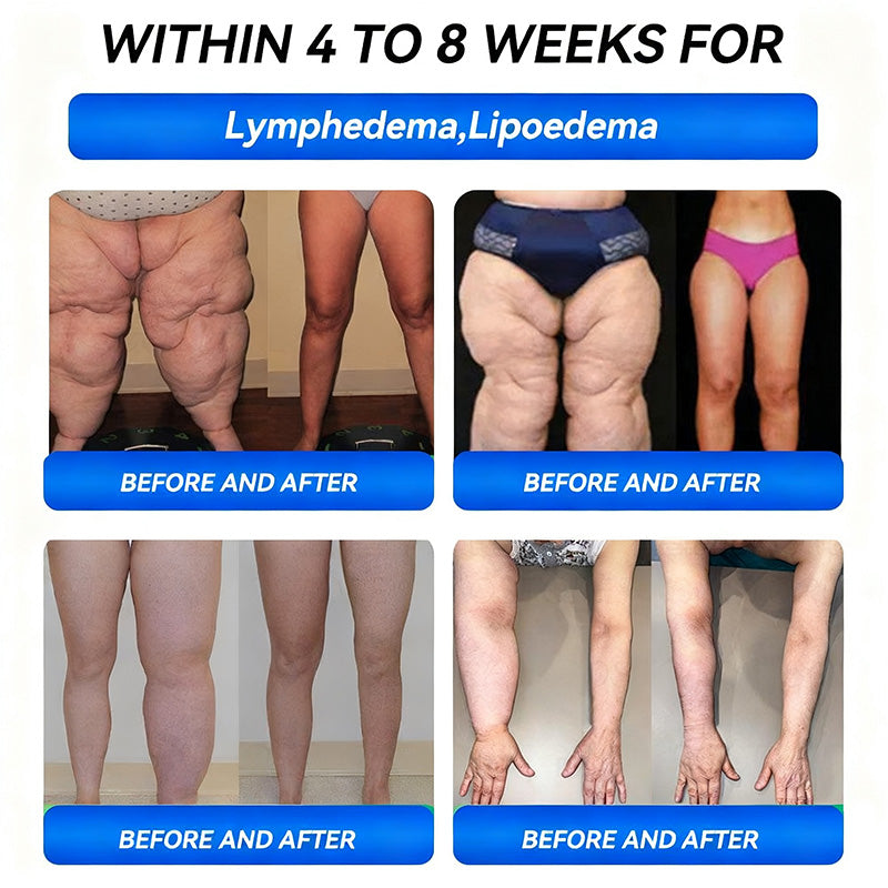 𝐻𝐶✅𝐎𝐟𝐟𝐢𝐜𝐢𝐚𝗜𝗜𝐲 𝐀𝐮𝐭𝐡𝐨𝐫𝐢𝐬𝐞𝐝 𝐄𝐱𝐜𝐥𝐮𝐬𝐢𝐯𝐞 𝐄𝐝𝐢𝐭𝐢𝐨𝐧 | 𝐻𝐻𝑉𝐵® 𝐆 𝗟 𝐏-𝟏 𝐏𝐫𝗼𝐛𝒊𝗼𝐭𝒊𝐜 𝐅𝐮𝗹𝗹-𝐁𝗼𝐝𝐲 𝐒𝐜𝐮𝗹𝐩𝐭𝐢𝐧𝐠 & 𝐇𝐞𝐚𝐥𝐭𝐡 𝐁𝗼𝗼𝐬𝐭 𝐋𝒊𝐭𝐭𝗹𝐞 𝐁𝗹𝐮𝐞 𝐉𝒂𝐫~Activate GLP-1 naturally and lose weight the easy way~Not just weight loss, but a full metabolic upgrade